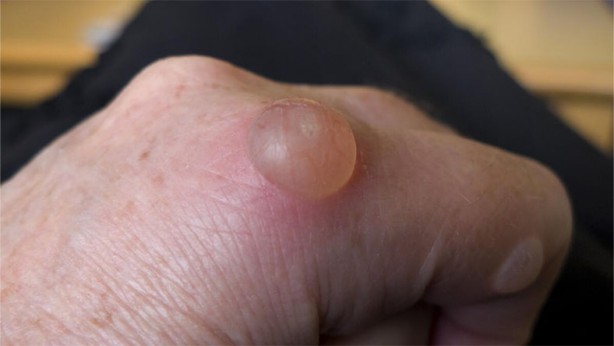 Foto - Su toplayan bir yeri neden patlamamamız gerektiğini öğrenince bir daha...