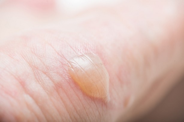 Su toplayan bir yeri neden patlamamamız gerektiğini öğrenince bir daha...