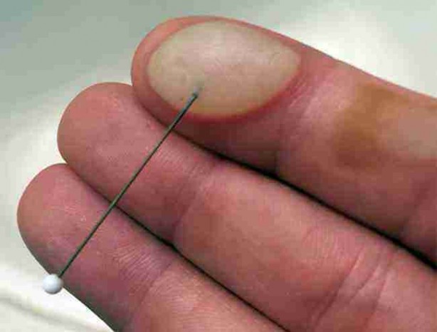 Foto - Su toplayan bir yeri neden patlamamamız gerektiğini öğrenince bir daha...