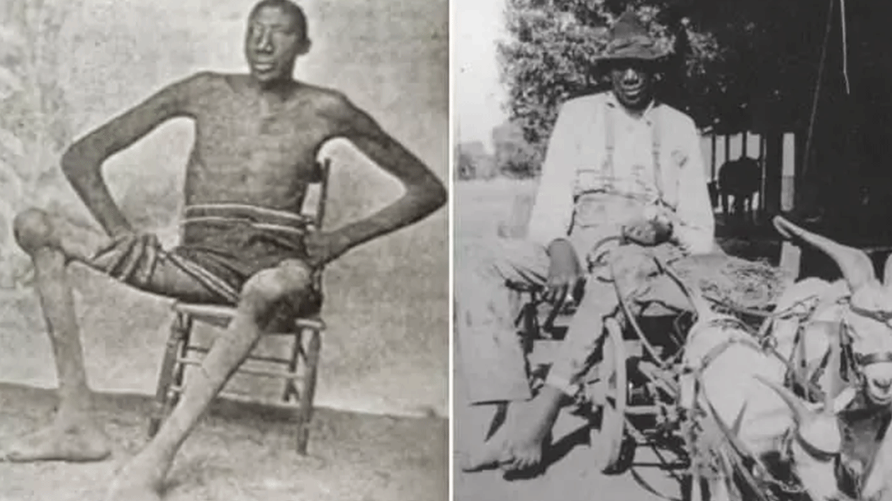 Foto - Sultan Köse bile cüce gibi kaldı! İşte tarihin en uzun boylu insanları