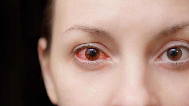 Foto - Sulu gözleri hafife almayın