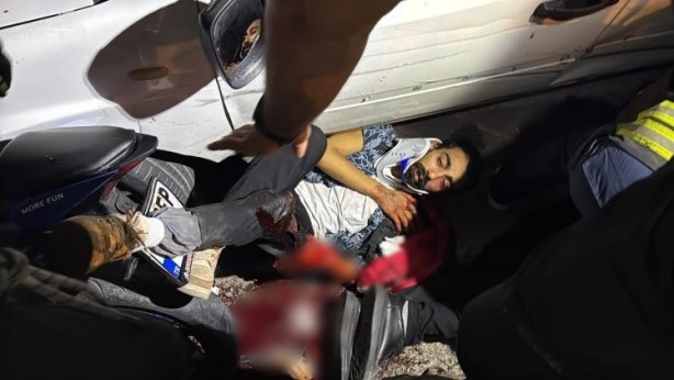 Foto - Sürat motorunu ölüme sürdü