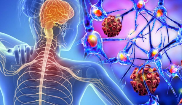 Foto - Sürekli yorgun hissedenler dikkat! Bu hastalıklardan birine yakalanmış olabilirsiniz