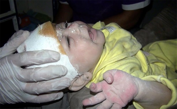 Foto - Suriye'de 1 aylık bebek böyle kurtarıldı