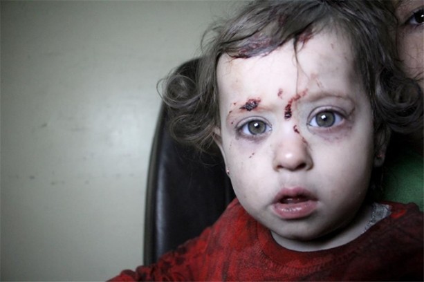 Foto - Suriye'de 1 aylık bebek böyle kurtarıldı