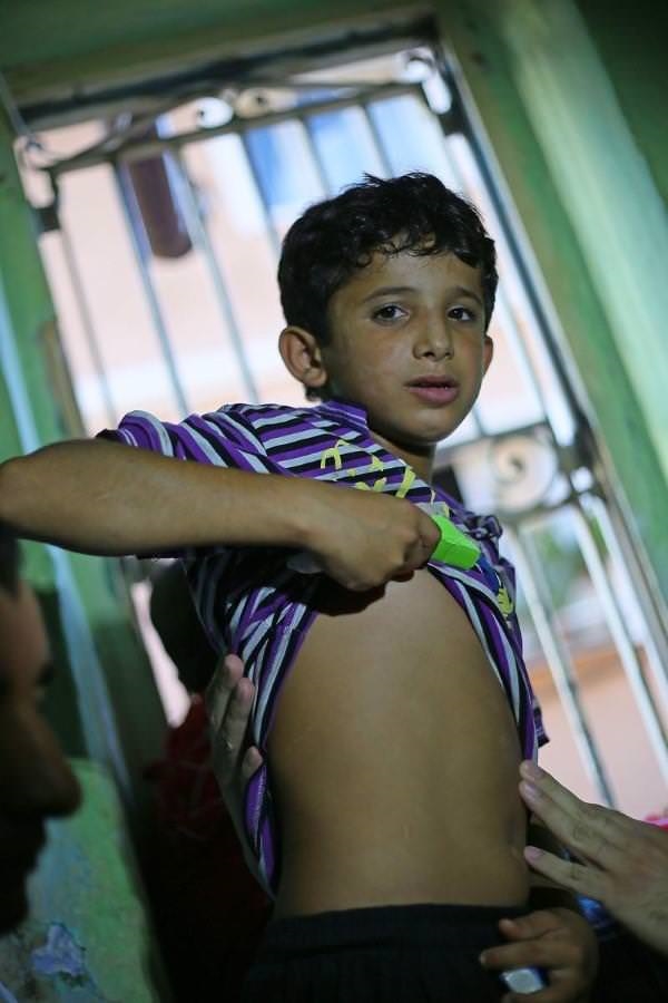 Foto - Suriyeli Ahmed'e bakın kim sahip çıktı!