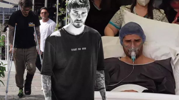 Foto - Survivor yarışmasında sakatlandı! Şimdi yürümekte bile zorlanıyor