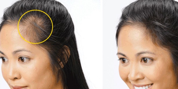 Foto - Susam yağı nelere iyi gelir? Merak edilen sorulara cevap veriyoruz... Hastalıklara meydan okuyor