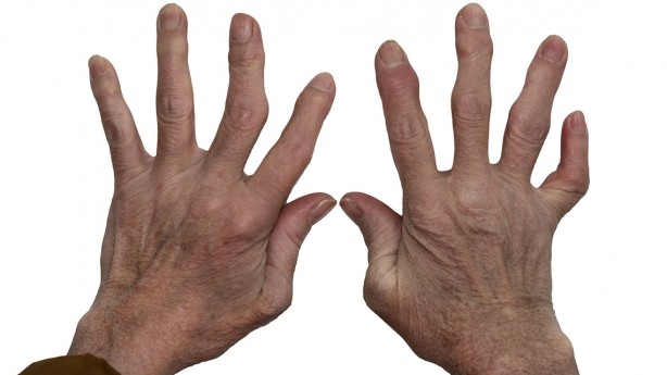 Foto - Susam yağı nelere iyi gelir? Merak edilen sorulara cevap veriyoruz... Hastalıklara meydan okuyor