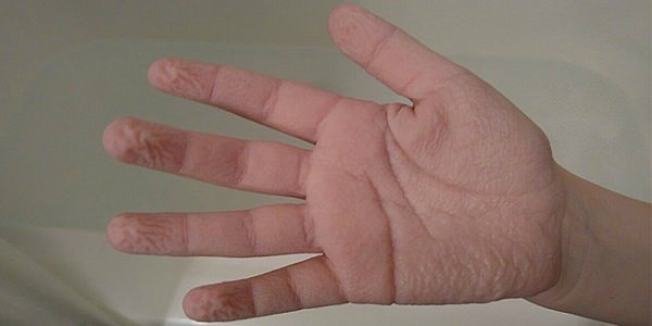 Foto - Suya girince parmaklarımız neden buruşur? Çok ilginç bir nedeni var!