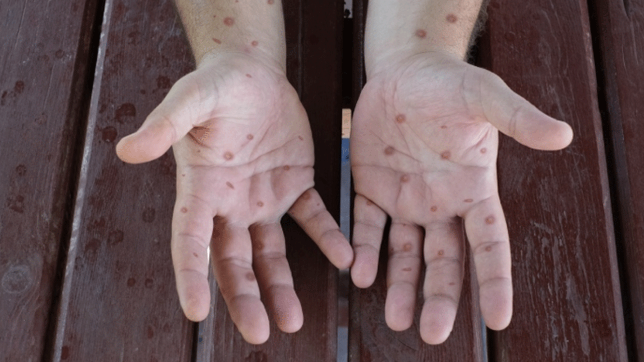 Foto - Diğerlerine fark attı! İşte Google'da en çok aranan kelimeler!