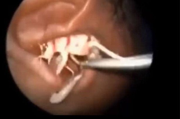 Foto - Talihsiz adamın kulağından böcek çıkarıldı!