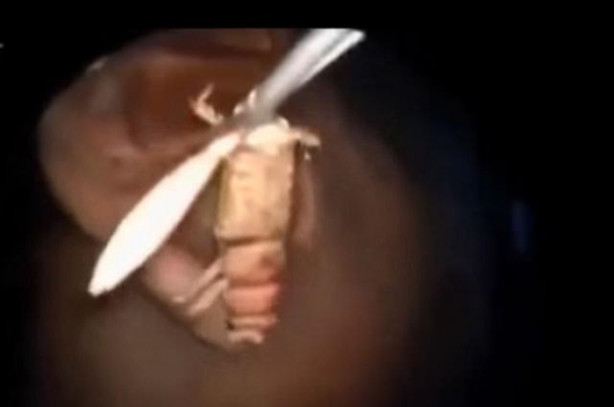 Foto - Talihsiz adamın kulağından böcek çıkarıldı!