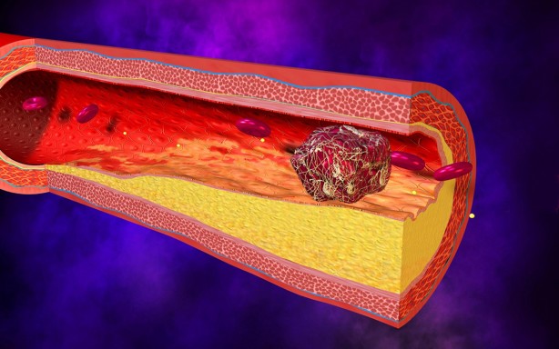 Foto - Tansiyon hastaları dikkat! Koronavirüs salgını...