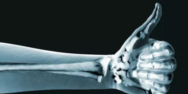 Foto - Tansiyonu düşüren süper yiyecek! Cilde iyi gelen yaban mersini kanseri önlüyor, kan şekerini dengeliyor