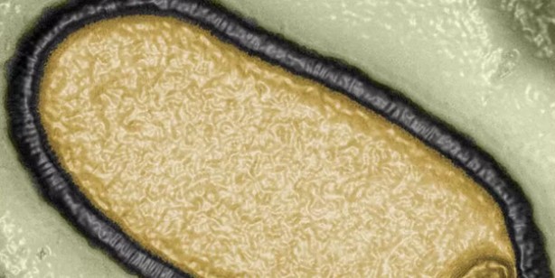 Foto - Tarihi keşif: 48 bin 500 yıllık 'zombi virüs' canlandı! Flaş iddia: enfeksiyona neden oldu! İşte o şok sözler