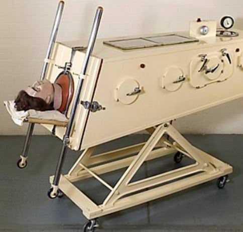 Foto - Tarihte kullanılan korkunç tıp ekipmanları