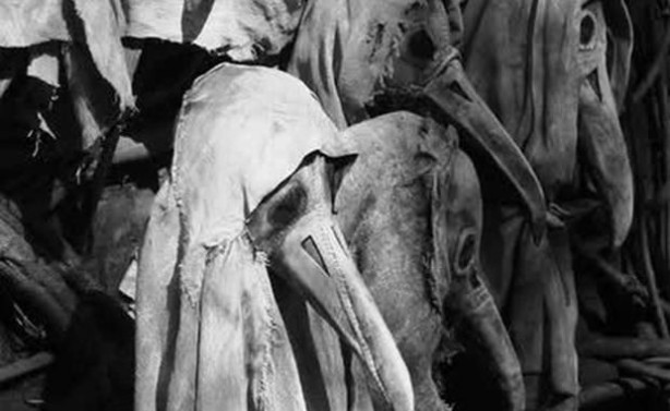 Foto - Tarihte kullanılan korkunç tıp ekipmanları