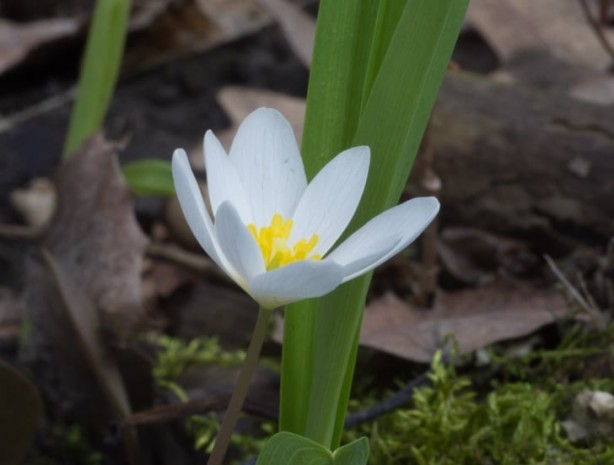 Foto - Tartar lekelerini dişlerinizden çıkarmanın 10 yolu! Artık gece gündüz şok görüntü: Işıl Işıl! Önlem alın