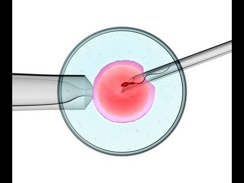 Foto - Taşıyıcı annelik caiz midir? Taşıyıcı annelik nedir?