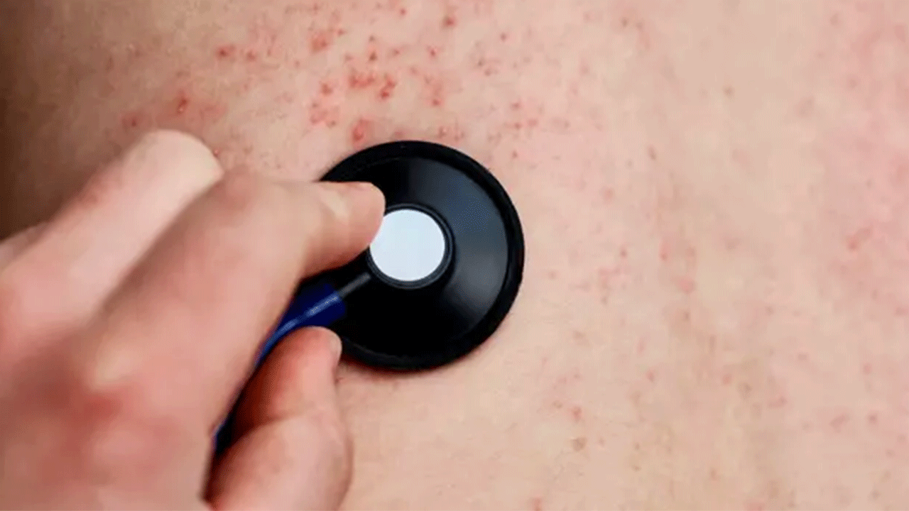 Foto - Tatil bölgelerinde bu belirtilere dikkat: Vakalarda patlama var!