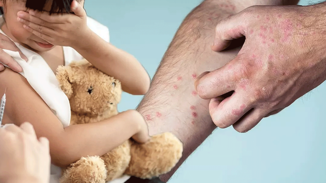 Foto - Tatil bölgelerinde bu belirtilere dikkat: Vakalarda patlama var!