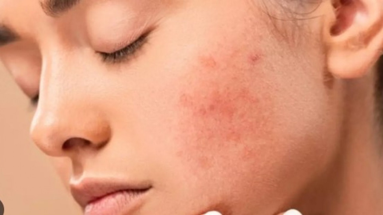 Foto - Tatilde bunları sakın yapmayın: Plaj keyfi burnunuzdan gelmesin!