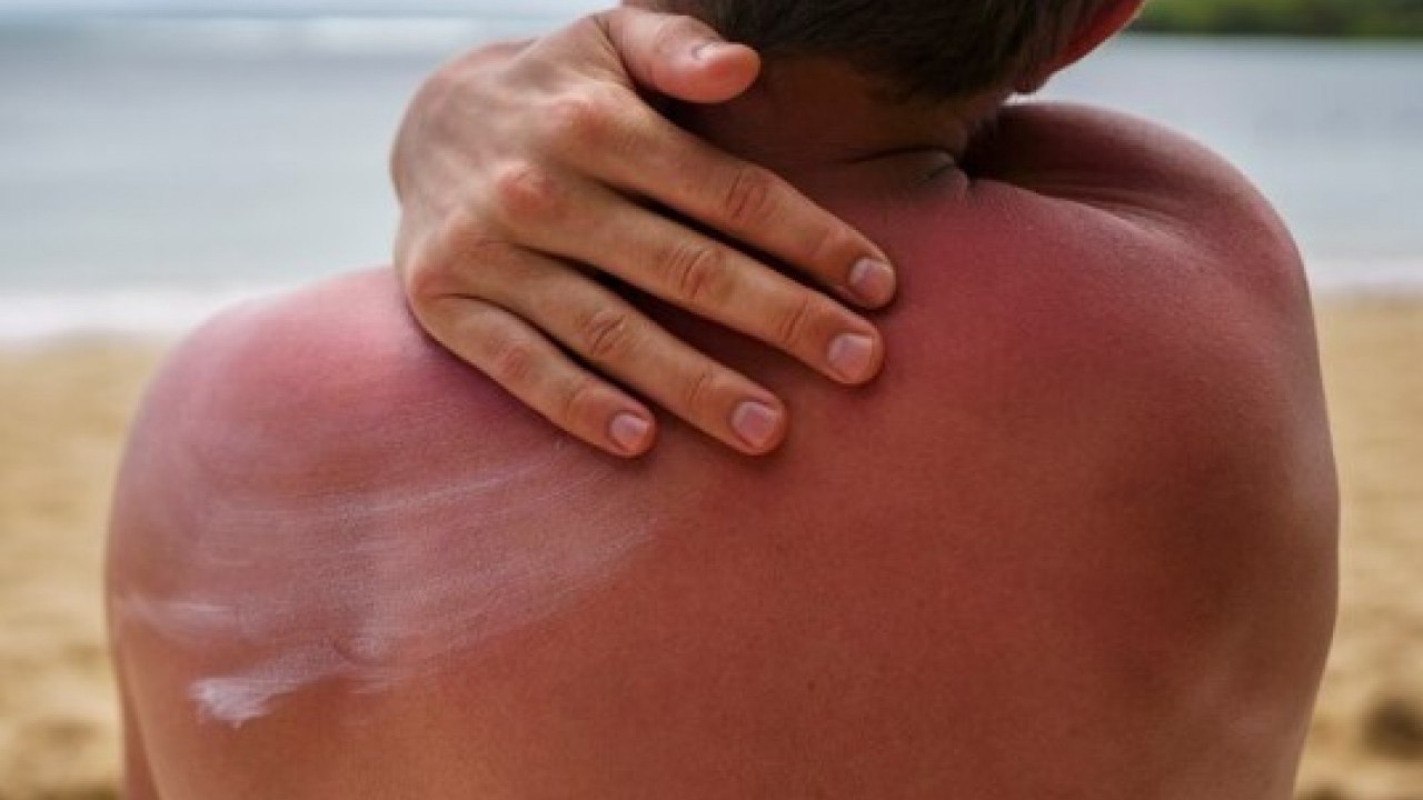 Foto - Tatilde bunları sakın yapmayın: Plaj keyfi burnunuzdan gelmesin!