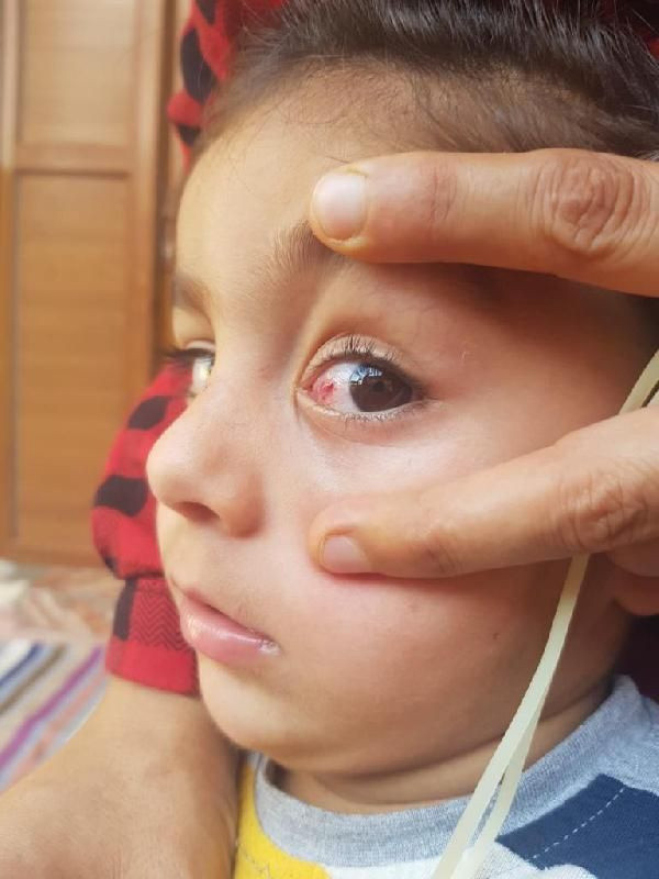 Foto - Tatilde bu hastalığa dikkat!