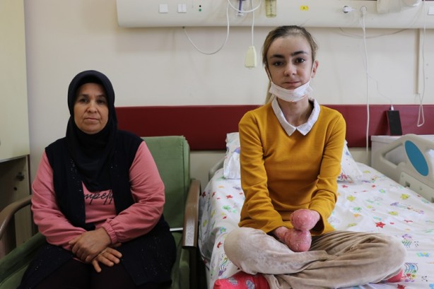 Foto - Tedavi edilen 6 kelebek hastası ilk kez katı gıdayla beslendi