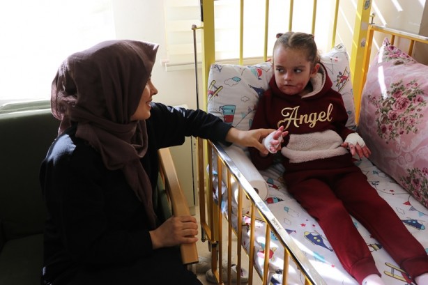 Tedavi edilen 6 kelebek hastası ilk kez katı gıdayla beslendi