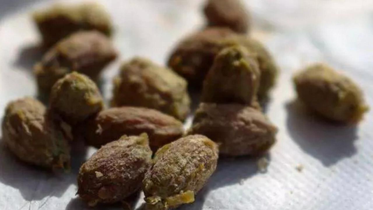 Foto - Tehlikeli mi sağlıklı mı? Zeytin çekirdeği yutulursa ne olur? Uzmanlar o sorunun cevabını verdi...