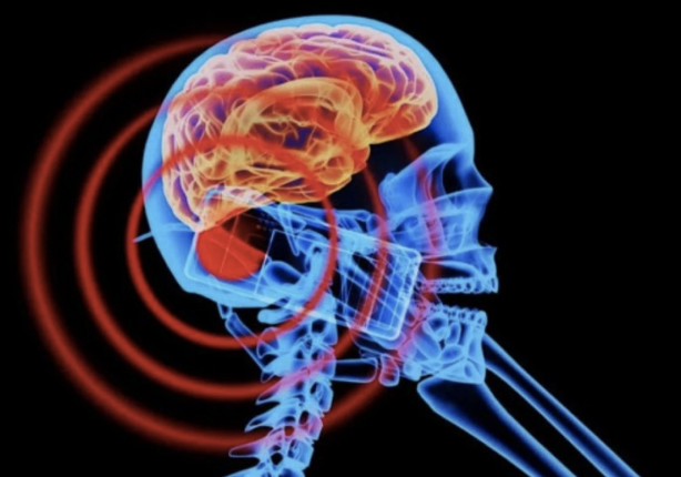 Foto - Telefon alırken SAR değerine dikkat! İşte en çok radyasyon yayan akıllı telefonlar! Radyasyona maruz kalmayı en aza indirmek için neler yapılmalı?