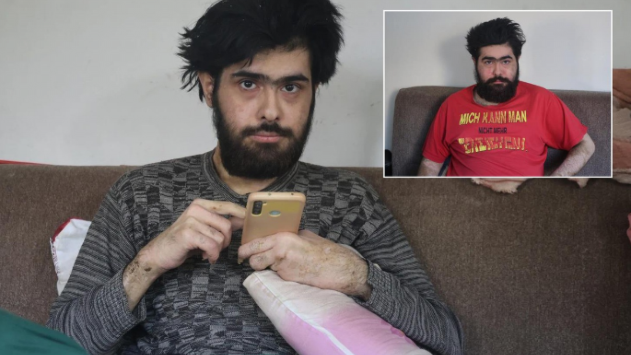 Telefon bağımlısı Barış Özbay'den yeni haber: 3 ay boyunca tedavi gördü! Ancak eski hayatına geri döndü