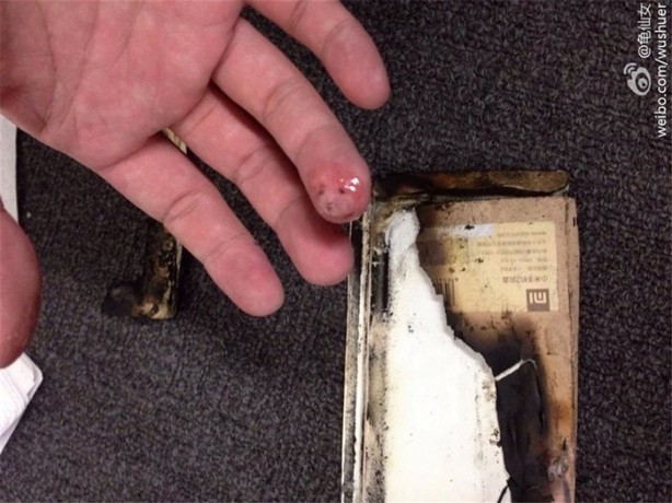 Foto - Telefonunuzu yastığın altına koymayın!