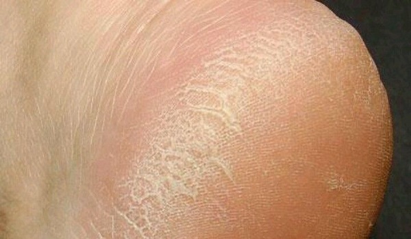 Foto - Temizlikle ilgili bildiğiniz her şeyi unutun! Tek bir ürünle tüm evi pırıl pırıl yapabilirsiniz