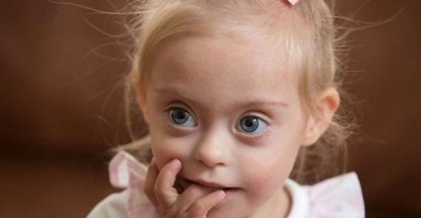 Foto - 21 adımda down sendromu 