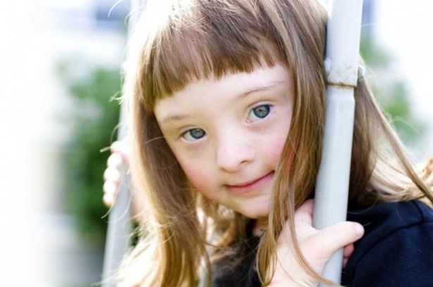 Foto - 21 adımda down sendromu 