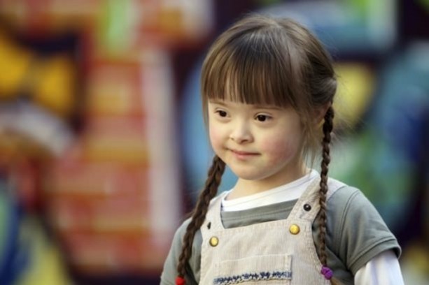 Foto - 21 adımda down sendromu 