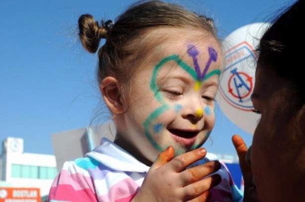 Foto - 21 adımda down sendromu 