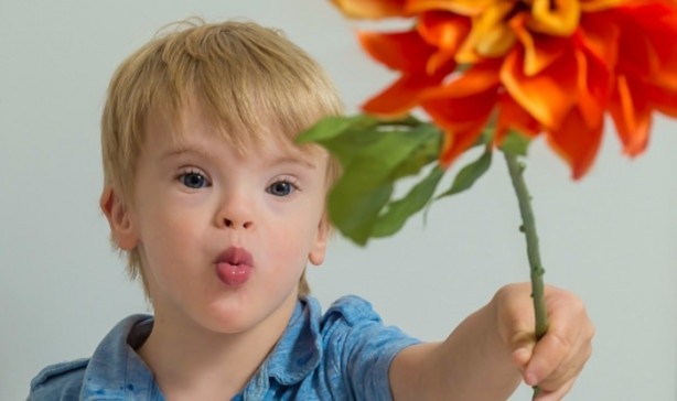 Foto - 21 adımda down sendromu 