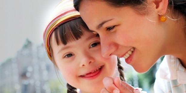 Foto - 21 adımda down sendromu 