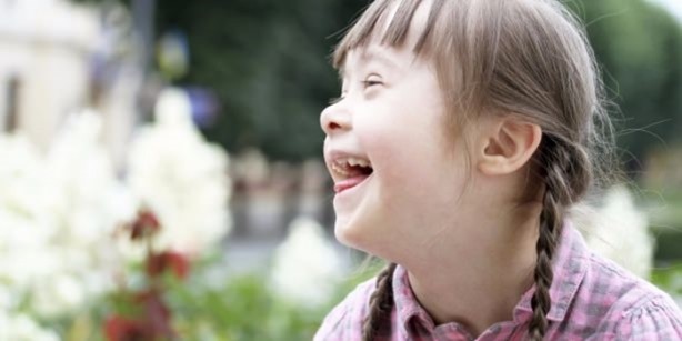 Foto - 21 adımda down sendromu 