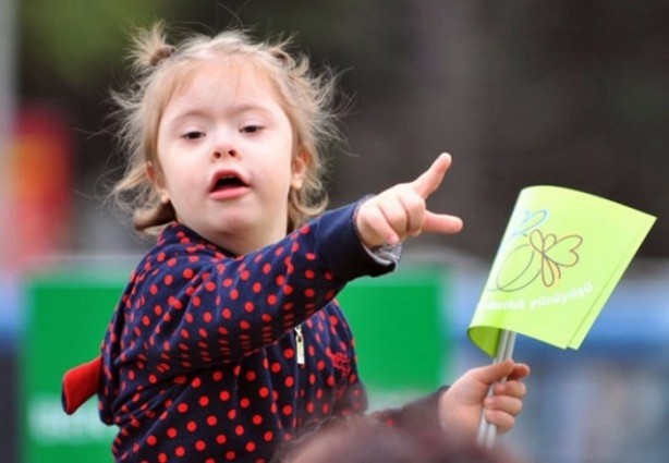 Foto - 21 adımda down sendromu 