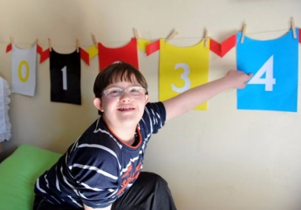 Foto - 21 adımda down sendromu 