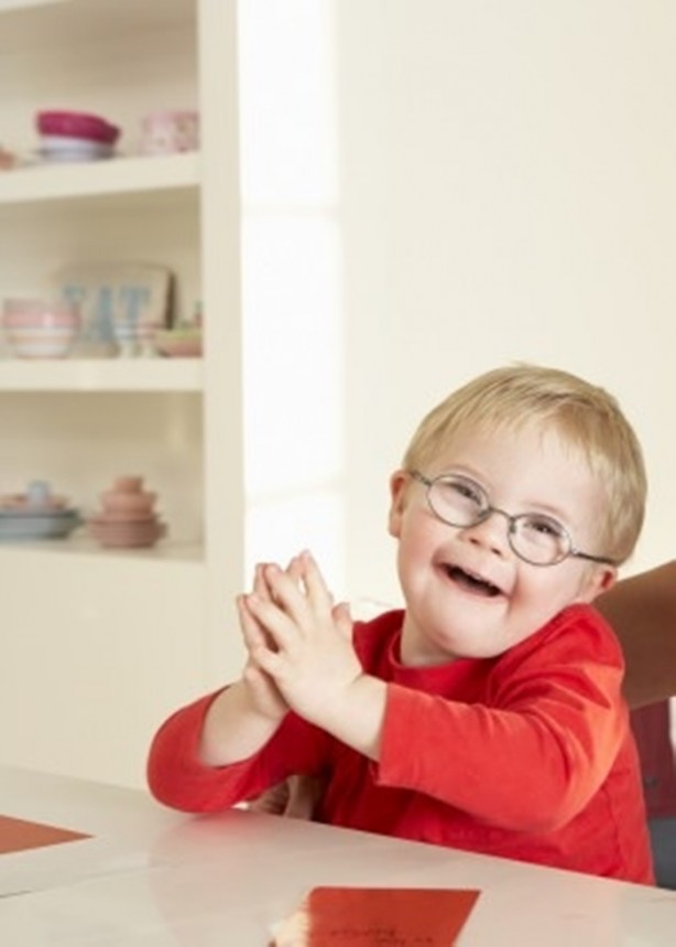 Foto - 21 adımda down sendromu 