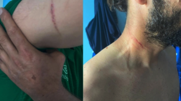 Foto - Terörist her yerde teröristtir! Terörist sadece dağda aranmaz