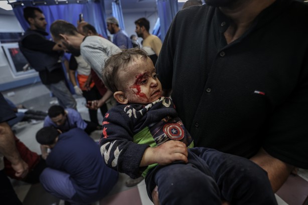 Foto - Terörist İsrail'in bombaladığı hastaneden feci görüntüler!