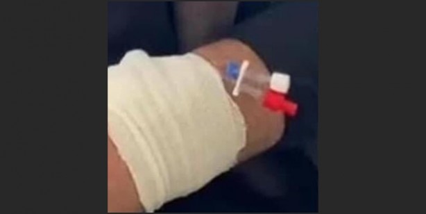 Foto - Ters mi taktılar? Ekrem İmamoğlu'nun hastanedeki görüntüsü olay oldu