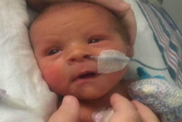 Foto - Tıp dünyasında bir ilk! Mıknatısla tutturdular